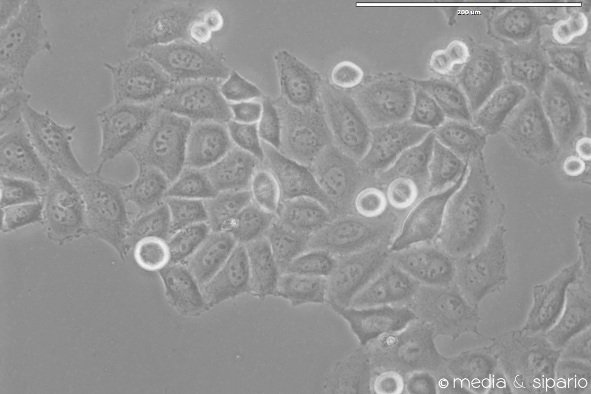 Henrietta Lacks, immortale suo malgrado